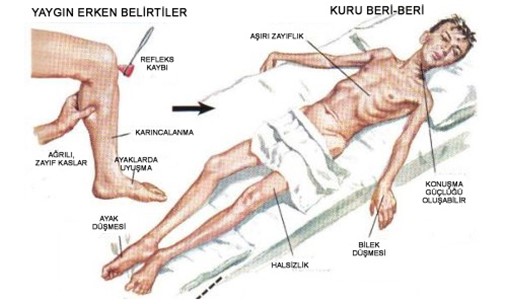 denizcilerde-gorulen-hastaliklar-3.jpg